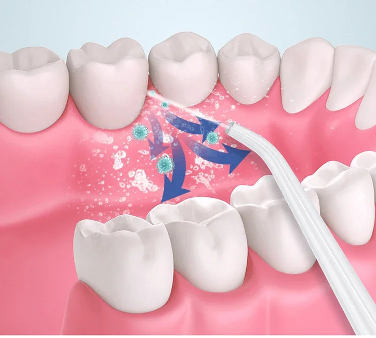 Bezprzewodowy Irygator do Zębów